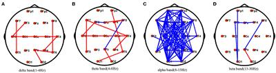 The micro and macro interactions in acute autoimmune encephalitis: a study of resting-state EEG